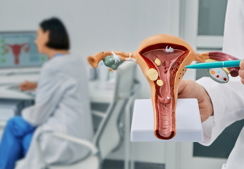 Doctor-pointing-to-model-of-female-reproductive-system-with-vaginal-cyst