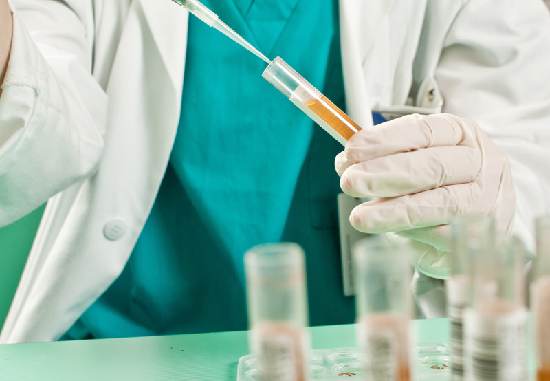Lab-technician-testing-urine-sample-for-recurrent-UTI