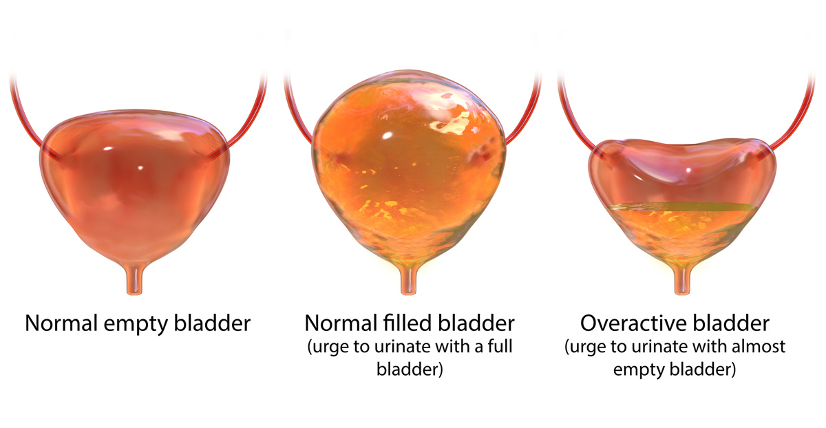 Overactive And Underactive Bladder Urogynecologist Pelvic Reconstruction Surgery Transgender 0923